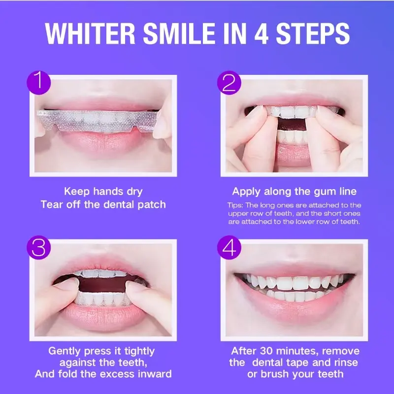 Teeth Whitening Kit - 5X LED L - Teeth Whitening Strips recensie en prijs