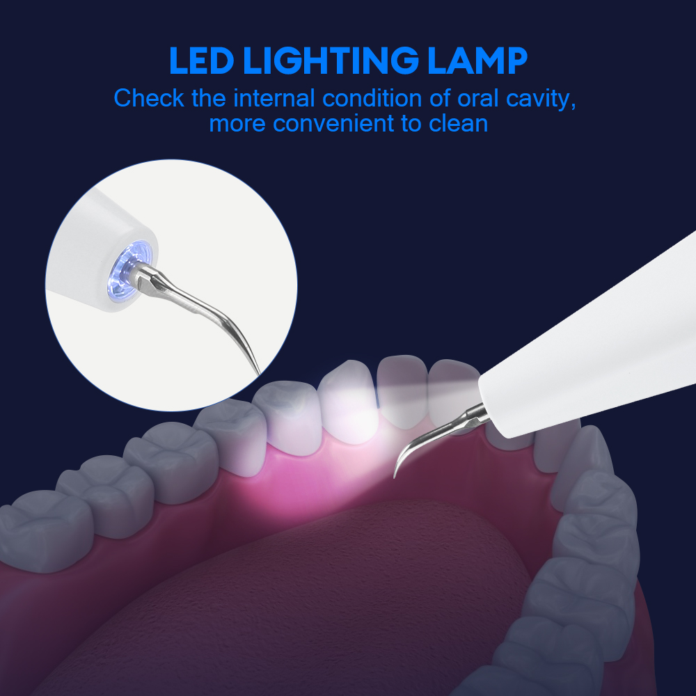 Ultrasonic Dental Calculus Rem - Teeth Whitening Strips recensie en prijs