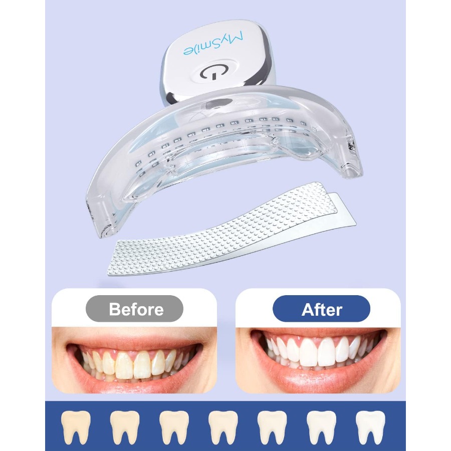Teeth Whitening Strips Kit wit - Teeth Whitening Strips recensie en prijs